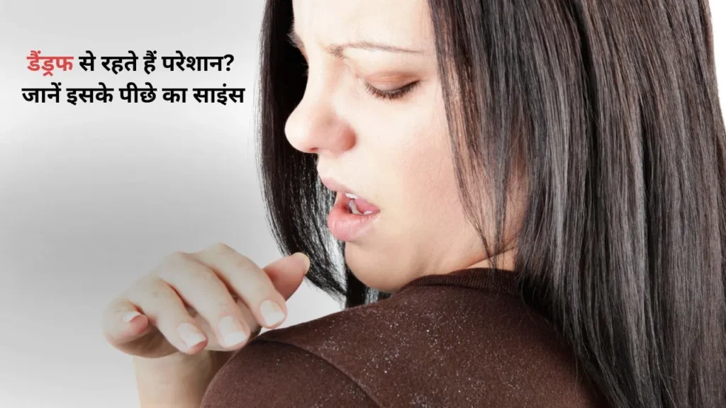 Monsoon Mein Dandruff