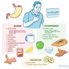 Acid Reflux Symptoms